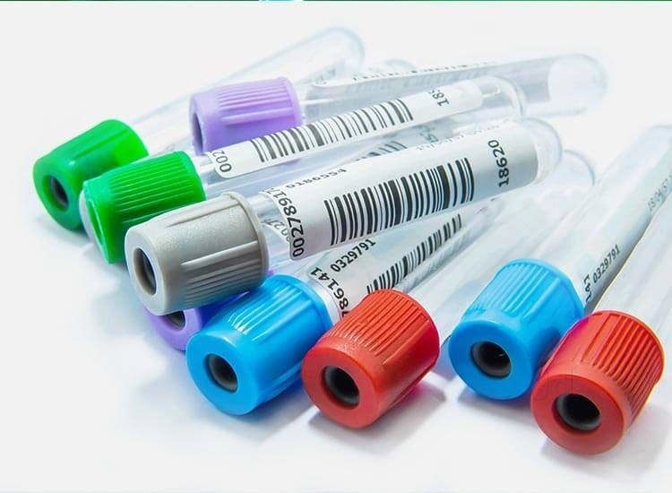 Arizona’s Blood Alcohol Content (BAC) Tests