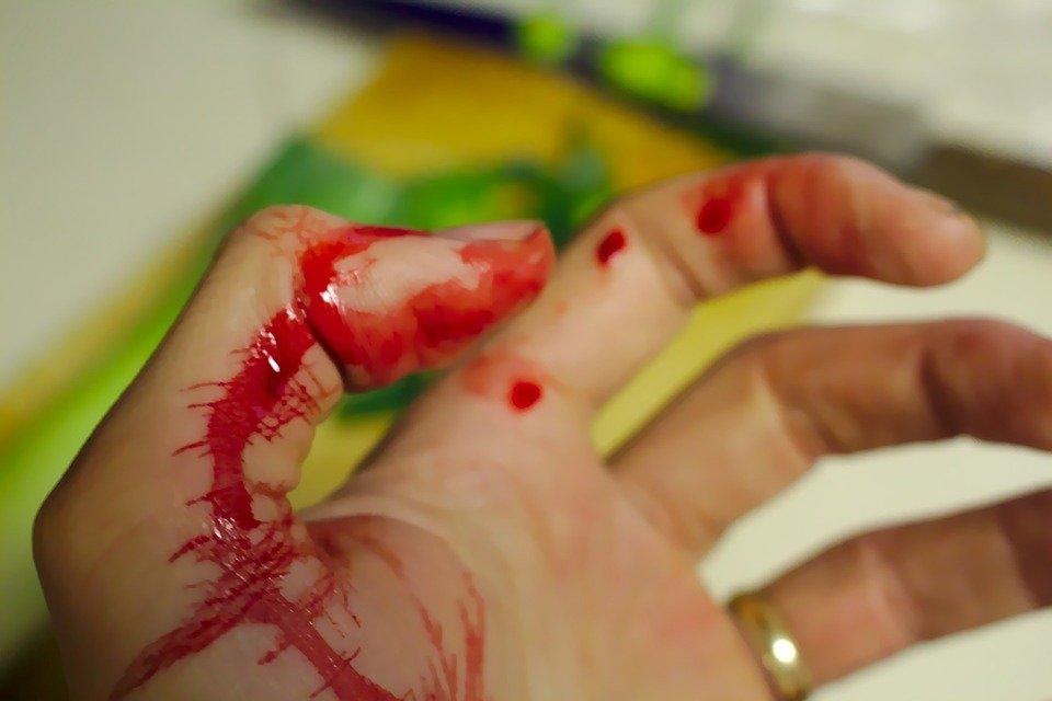 What to Do When You Get Injured at Work